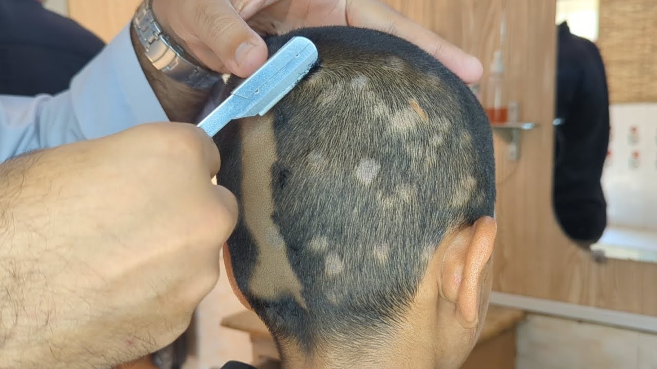 Dandruff remove Head shave zaibi barber shop