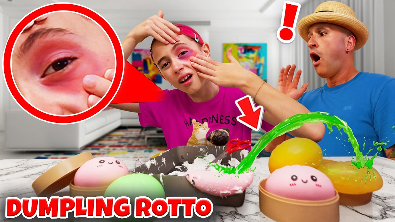 GIORGIA ROMPE UN DUMPLING SQUISHY SI IRRITA L'OCCHIO E FINISCE IN OSPEDALE! 