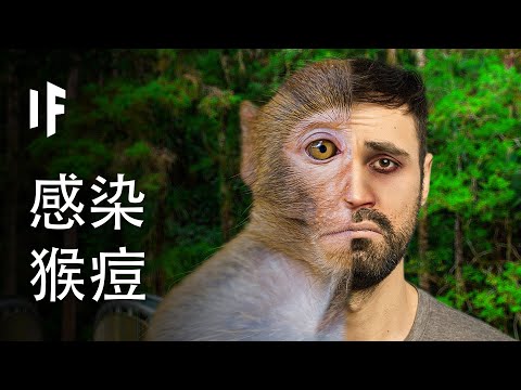 如果你感染猴痘【中文字幕】｜大膽科學