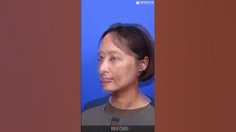 라봄성형외과 - Youtube