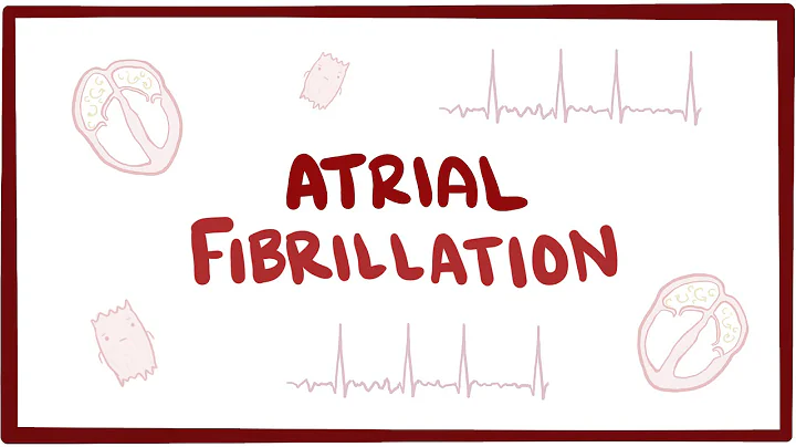 Atrial fibrillation (A-fib, AF) - causes, symptoms, treatment & pathology