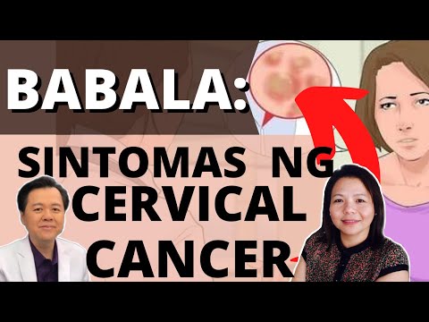 Babala: Sintomas ng Cervical Cancer - By Doc Freida and Doc Willie Ong