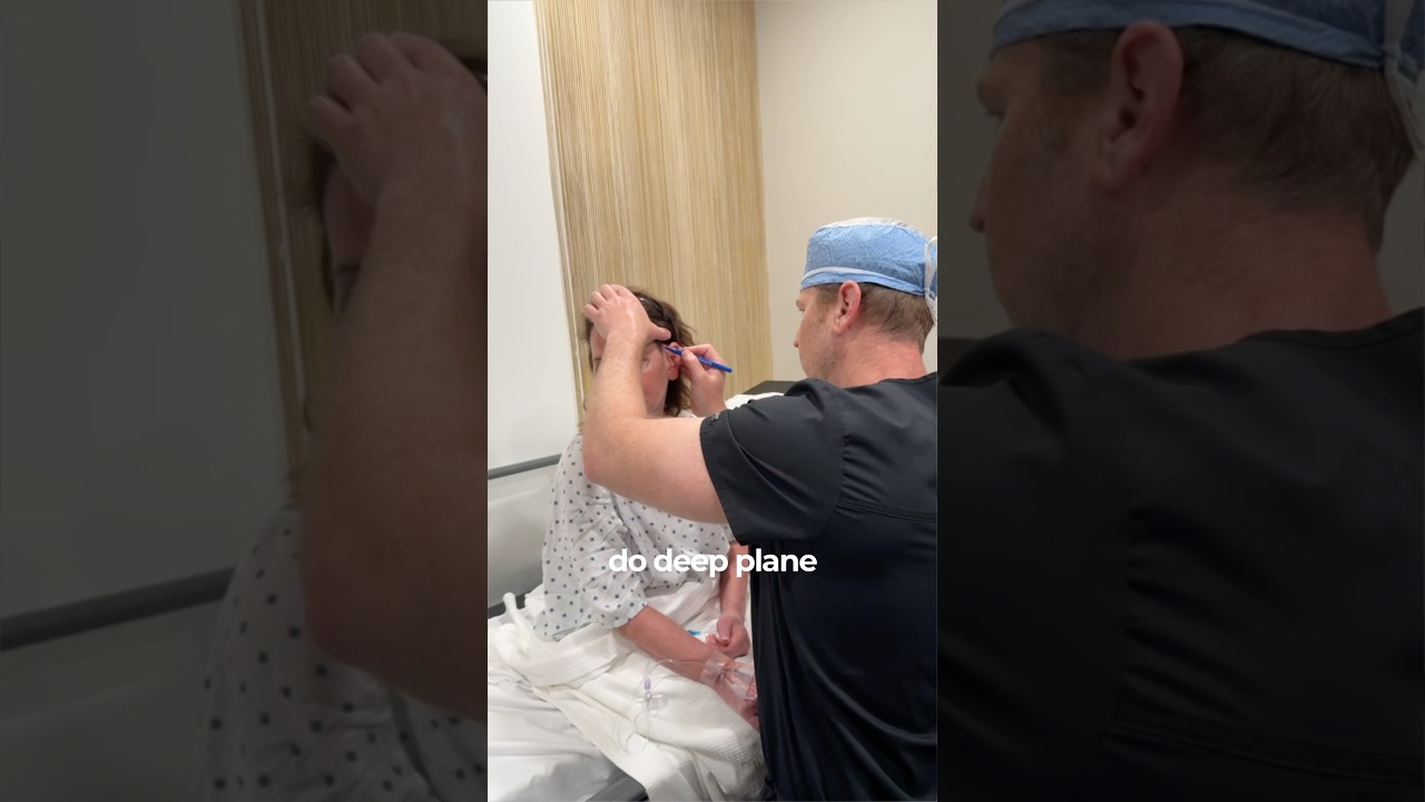 Why don’t all surgeons perform deep plane￼ facelifts?