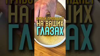 Домашняя смесь убивает грибок на глазах #здоровье