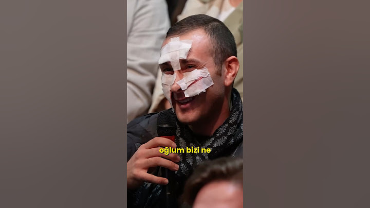 Yüz nakli olup itiraf etmeye gelmek :) #eystv #eseryenenler #itiraf
