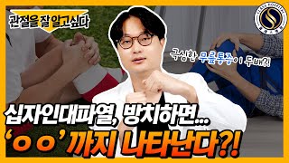 십자인대파열, 합병증까지 발병할 수 있다고?😲 #관절을잘알고싶다 #관잘알｜전방십자인대파열 재건술 3편