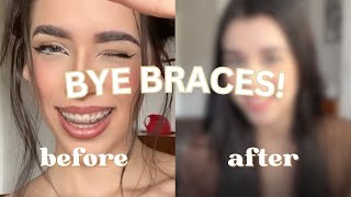 getting my braces removed (FINALLY) + a day in my life 💐 | Zarias