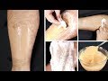 In 3 minutes Remove Unwanted Hair । NO SHAVE NO WAX - अनचाहे बालों से छुटकारा