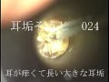 耳垢そうじ/耳が痒い長い耳垢/024