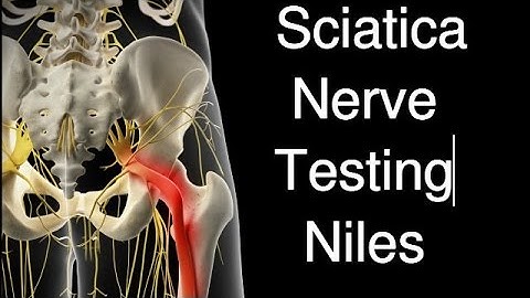 Sciatica Nerve Test Des Plaines
