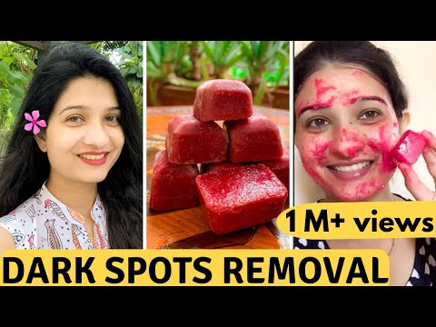 Dark spots removal | vegetable & Beetroot Ice cubes for dark spots | Remove Dark spots naturally
