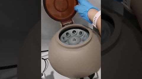 Urine under the microscope #laboratory #microscope #mls #cls #medtechstudent