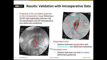 MDICx Series: Heart & Vasculature