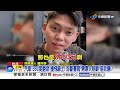 車禍被寫"需專人照顧"賠到爆?! 被撞"變醜"能求償60萬!│中視新聞 20260606