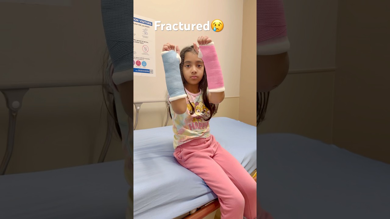 She broke her wrists bone of both hands Malia ki haddiyan tor li #fracture#broken#shortsfeed #shorts