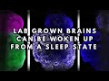 Lab Grown Mini Brains Can Be Woken Up From Sleep-Like States 