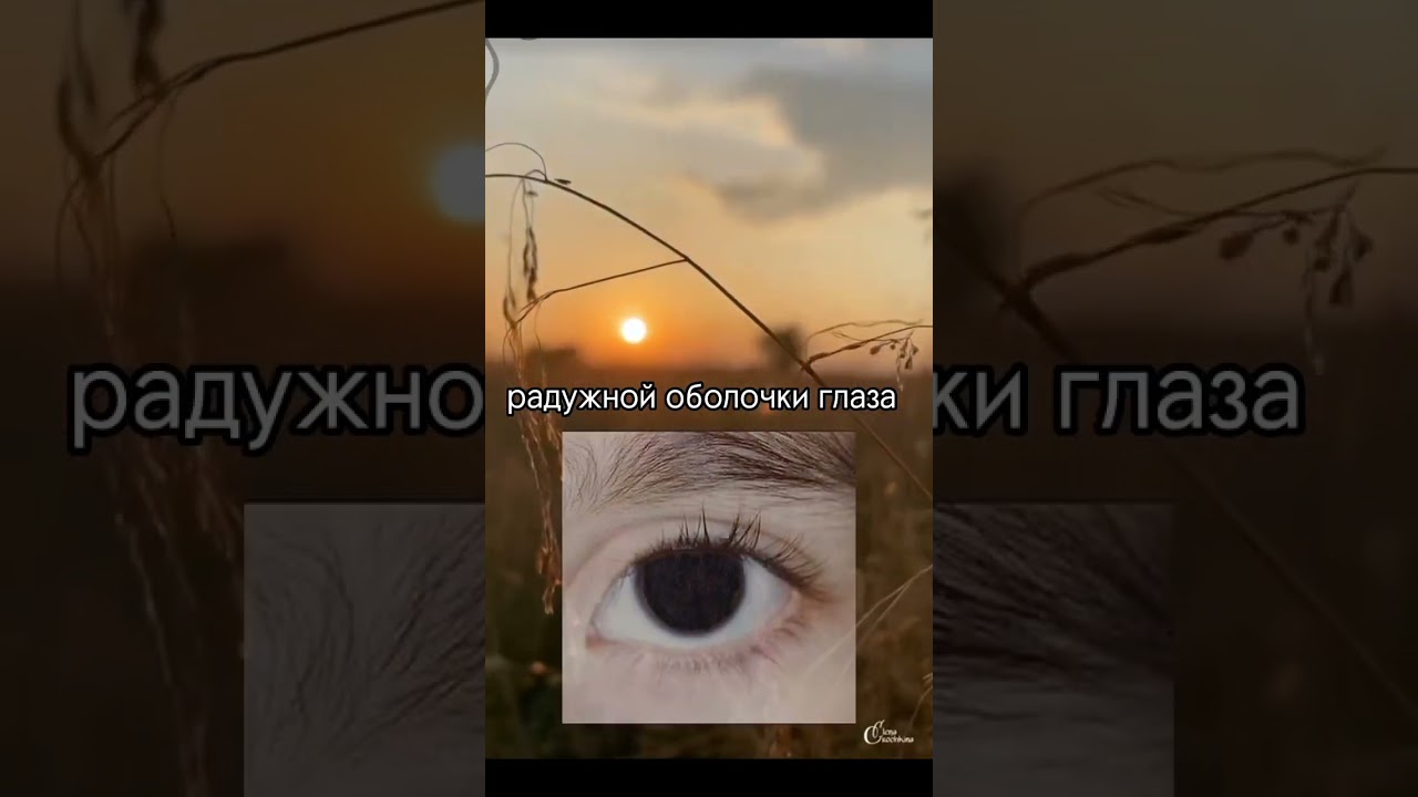 а у вас есть аниридия?#shorts #факты #short #познавательно #рекомендации #shortsvideo