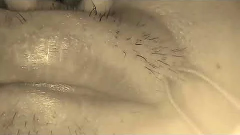 Remove the hair of the face. I finally extended to here, but it was fun to remove my hair.