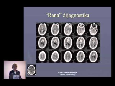 Neurohirurški aspekti tretmana visoko gradusnih glioma   Danica Grujicic