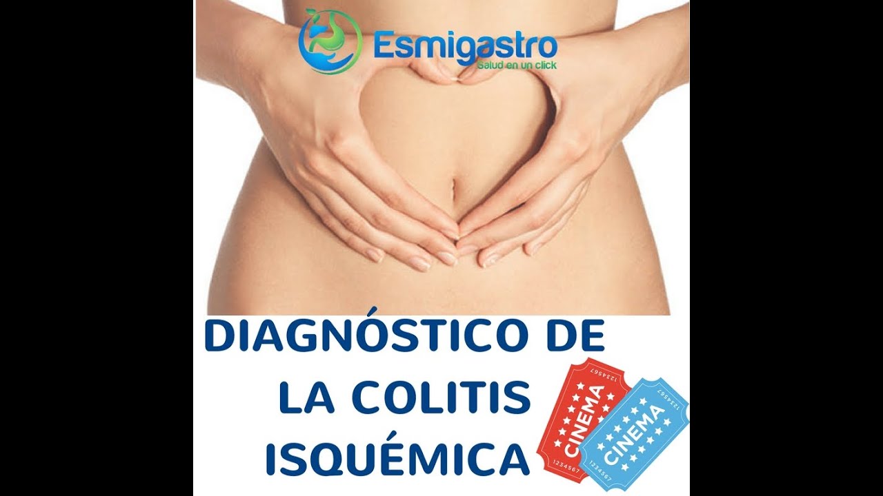 Diagnóstico de la Colitis Isquémica saludos amigos dvd