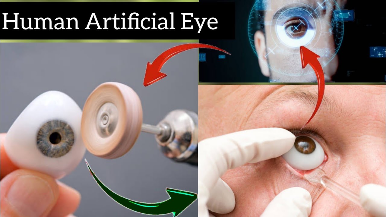 Human Artificial Eye. Replaced human Eye....