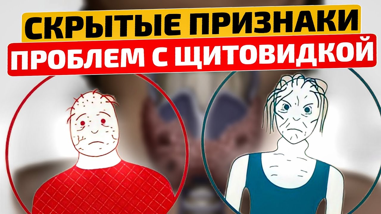 Вот ТАК щитовидка молит о помощи! Симптомы заболевания щитовидной ...