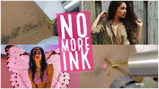 Tattoo Removal Boynton Beach | No More Ink | Melissa Carby | Body Details