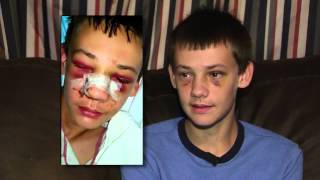 Baseball Bond Archie Bradley And Teen Hit By Line Drives On The Same Day