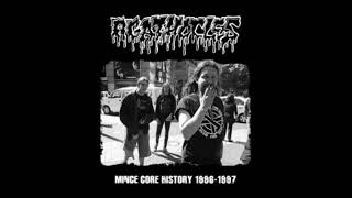 Agathocles - Mince Core History 1996-1997 (2008)