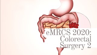 eMRCS 2020: Colorectal Surgery 2