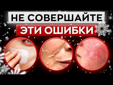 5 ошибок в уходе за лицом ЗИМОЙ / Какие ОСОБЕННОСТИ у зимнего ухода за кожей?