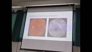Clase 30 - El ojo y las enfermedades sistemicas 