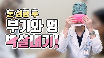 의사가 직접 알려준다!! 수술 후 멍 부기 빼는법!! 쌍수하고 붓기와 멍으로 더이상 울지마ㅠ