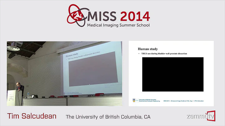 MISS 2014 (13) - Tim Salcudean (University of British Columbia, CA)