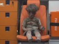 صورة الطفل عمران تصدم العالم وتشهد على صمود حلب 