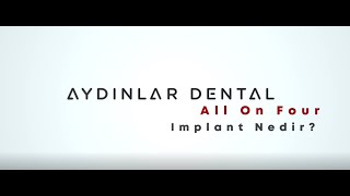 All-On-4 Tedavisi Nedir?