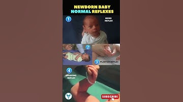 Newborn baby normal reflexes explained ✅ Moro reflex | Plantar reflex | Grasping reflex #reflexes