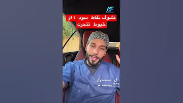 تشوف نقاط سودا او خيوط تتحرك 
