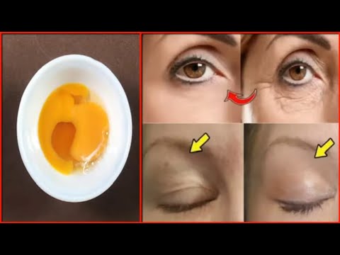 Video: Cách Xóa Mắt ác Bằng Trứng