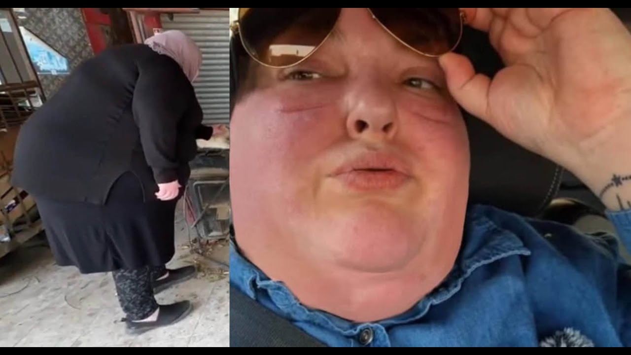 FOODIE BEAUTY CANT TAKE THE HEAT!