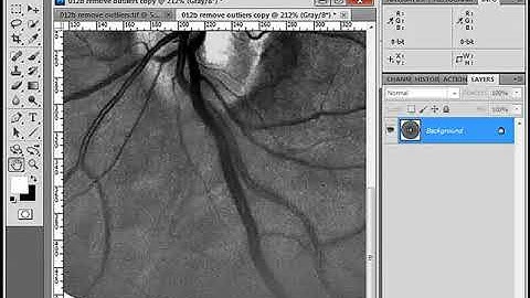 021 Noise Reduce Image Size Method