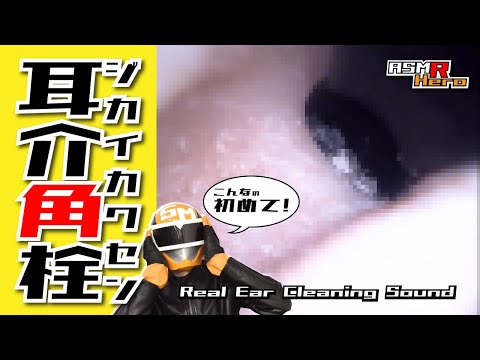 【イヤースコープASMR】耳介の角栓！？を耳かきで取る音/本物耳かき音 Real Ear Cleaning Sound /SONY コンデンサーマイクECM-PC60/no talking