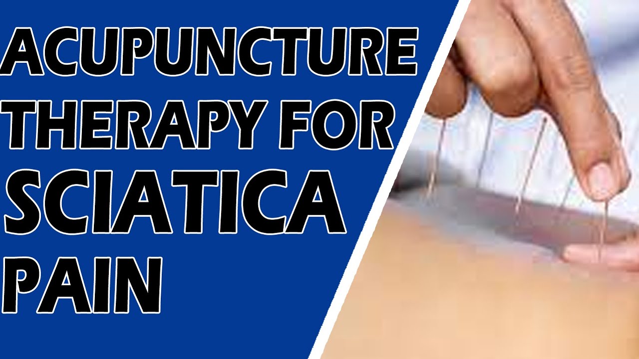 How to Relieve Sciatica Pain | Acupuncture Therapy | DR G Subash ...