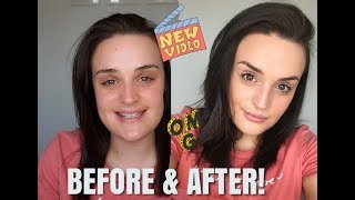 TESTING MAKEUP REVOLUTION CONCEAL & HYDRATE FOUNDATION & CONCEALER!
Hey you lovely bunch!
Welcome to the video.
In todays video I will be testing out the new makeup revolution foundation & concealer.
Makeup revolution is my go to brand now Im vegan, theyre affordable and high quality!
Hope you enjoy this one, let me know in the comments if you do :)
Lots of love,
Grace xo
If you would like to support my channel, please click this link;
https://www.patreon.com/grace_elizabeth/
MUST WATCHES:
. Cowspiracy
. What the health
. Earthlings
. The best speech you will ever hear
. 101 reasons to go vegan
.Land of hope & glory
YOU CAN FIND ME ON...
INTAGRAM-
https://www.instagram.com/graceebmakeup
https://www.instagram.com/graceeblife TESTING MAKEUP REVOLUTION CONCEAL & HYDRATE FOUNDATION & CONCEALER!