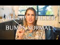 Are Lip Filler Bumps Normal? • Aesthetic MdR