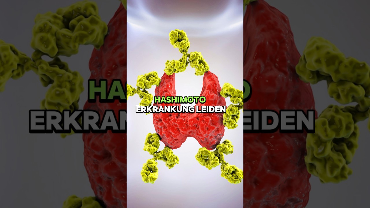 LDN bei Hashimoto - Erfahrung, Symptome und Wirkung#hashimoto #gesundheit #ldn #ern&auml;hrung #Arzt