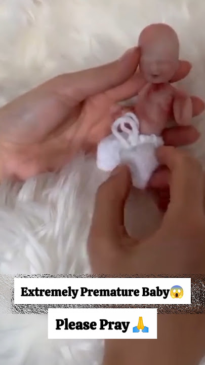 Extremely premature baby😱 Please pray🥺🙏 #baby #premature #prematurebaby #newborn #shortvideo #shorts