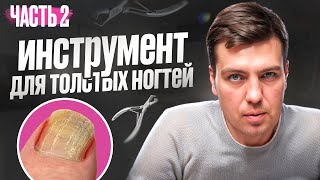 Как стричь толстые и жесткие ногти на ногах дома самому, проблемный ноготь. Педикюрный инструмент.