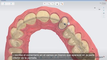3Shape TRIOS - Analyze page  tools ES