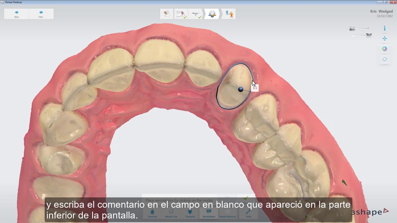 camera iphone 8 plus apk 3Shape TRIOS - Analyze page tools ES